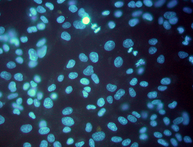 Mycoplasma_Indirect_culture